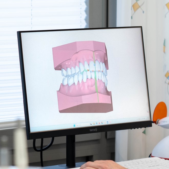 Kieferorthopädische Praxis Dr. Lackner Behandlung Digitale Technik